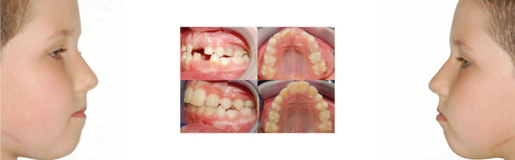 Ortodonzisti a Montagnana | Clinica Dentale Mantoan